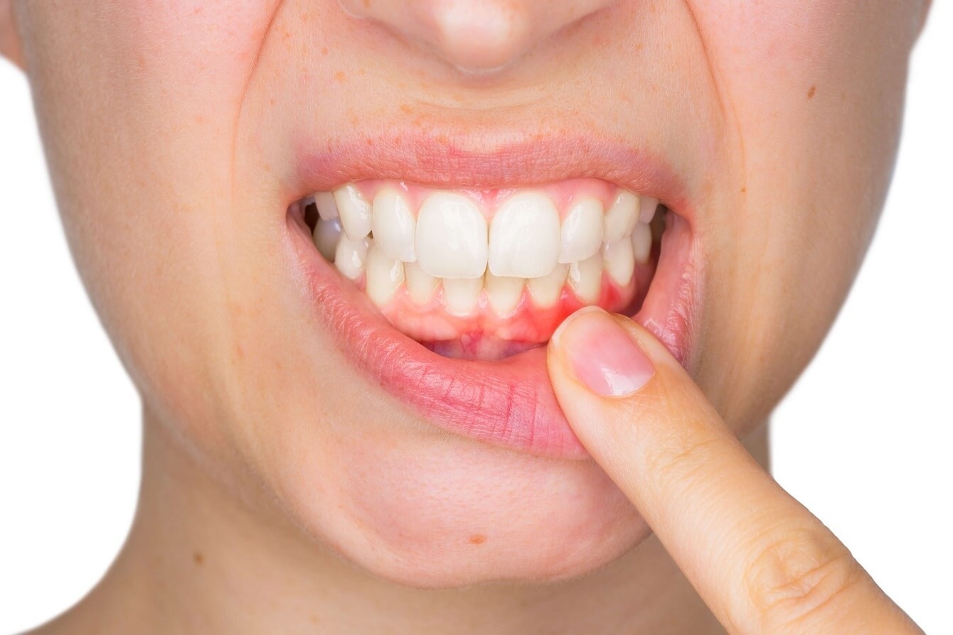 Periodontoloji (Diş Eti ve Hastalıkları)
