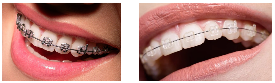 ORTODONTİ VE DENTOFASİYAL ORTOPEDİ